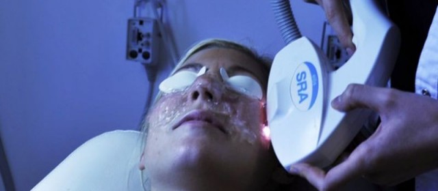 Bliv endnu smukkere med laserbehandlinger